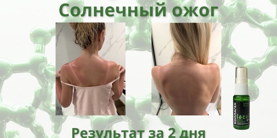 Лекол
