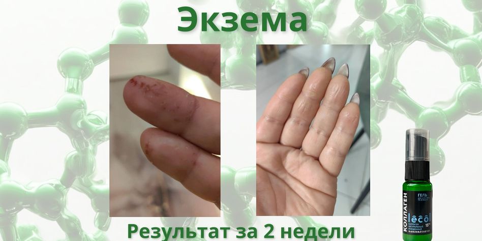 Лекол