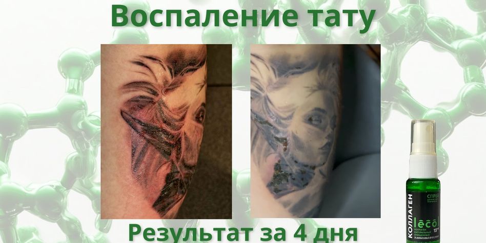 Лекол