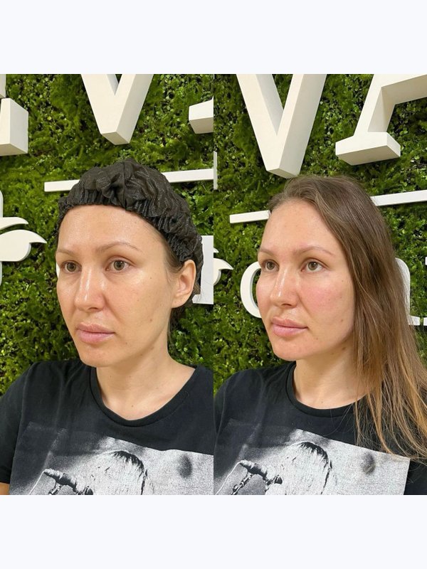 Без следов усталости Full face