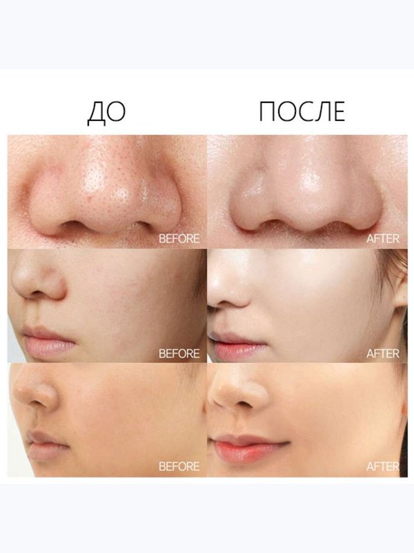 [ESTHETIC HOUSE] КАРБОКСИТЕРАПИЯ CO2 Esthetic Formula Carbonic mask
