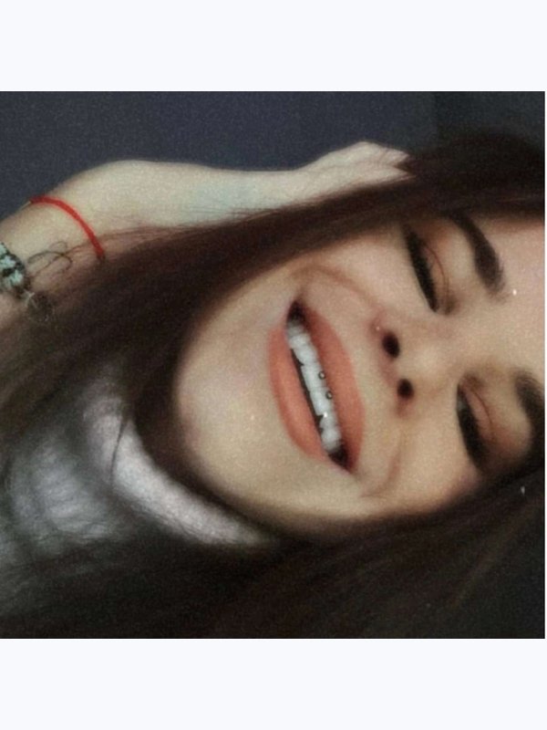 Пирсинг смайл