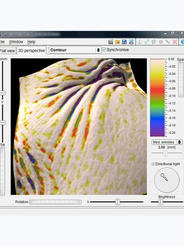 Консультация по косметологии и 3D диагностика кожи