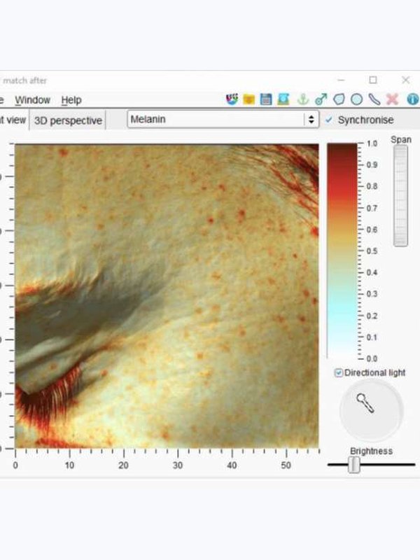 Консультация по косметологии и 3D диагностика кожи
