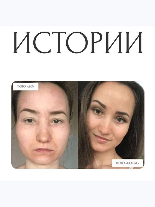 КАК ИЗБАВИТЬСЯ ОТ СЕДИНЫ