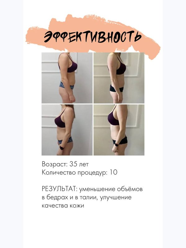 Magic Shape – 4 технологии в одном аппарате