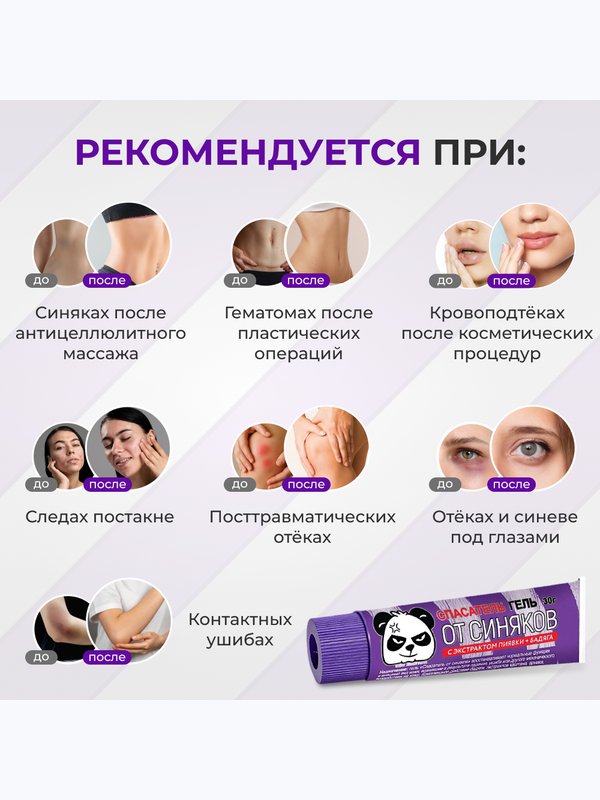 Гель от синяков и отёков СПАСАТЕЛЬ