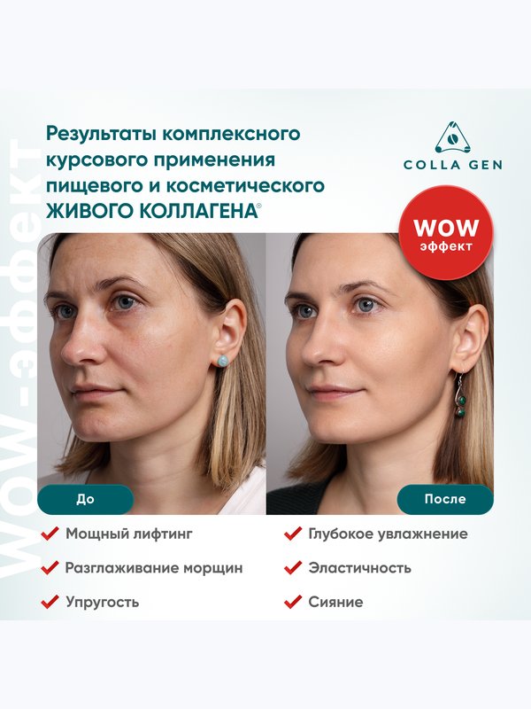 Крем для лица на основе ЖИВОГО КОЛЛАГЕНА. Увлажнение и лифтинг, 75 мл