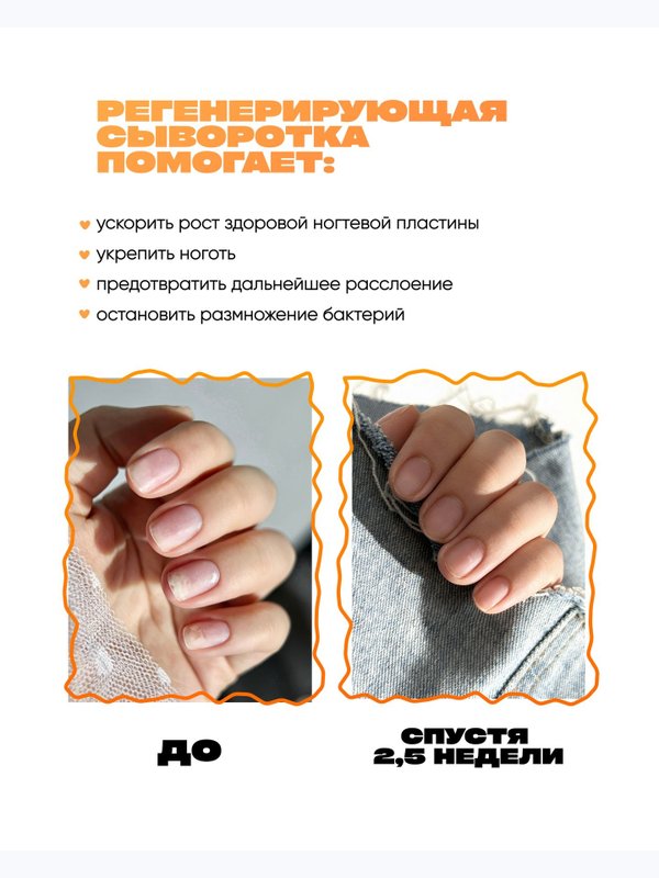Сыворотка регенерирующая для ногтей при онихолизисе
