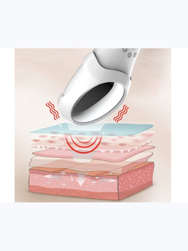 Aparat masaj facial inSPORTline Giva 23083 (6374)