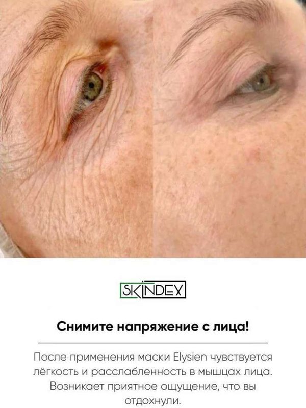 Мгновенное WOW омоложение