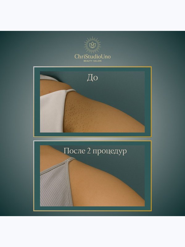 Бикини классический