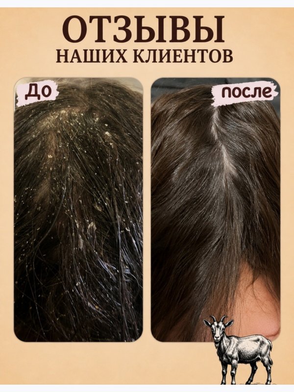 Твердый шампунь ММ • себорея • псориаз • зуд