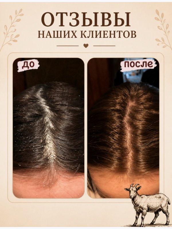 Твердый шампунь • выпадение • перхоть • зуд