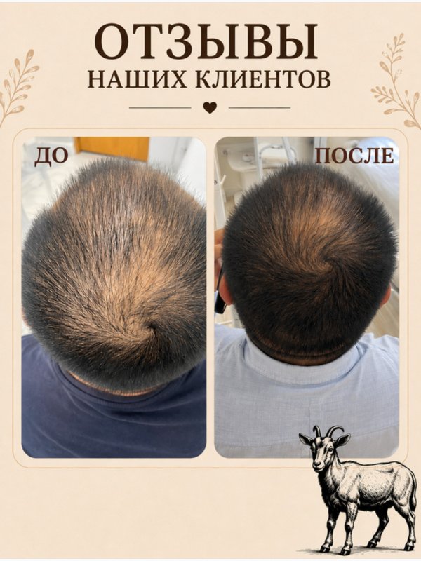 Твердый шампунь • рост • восстановление • питание