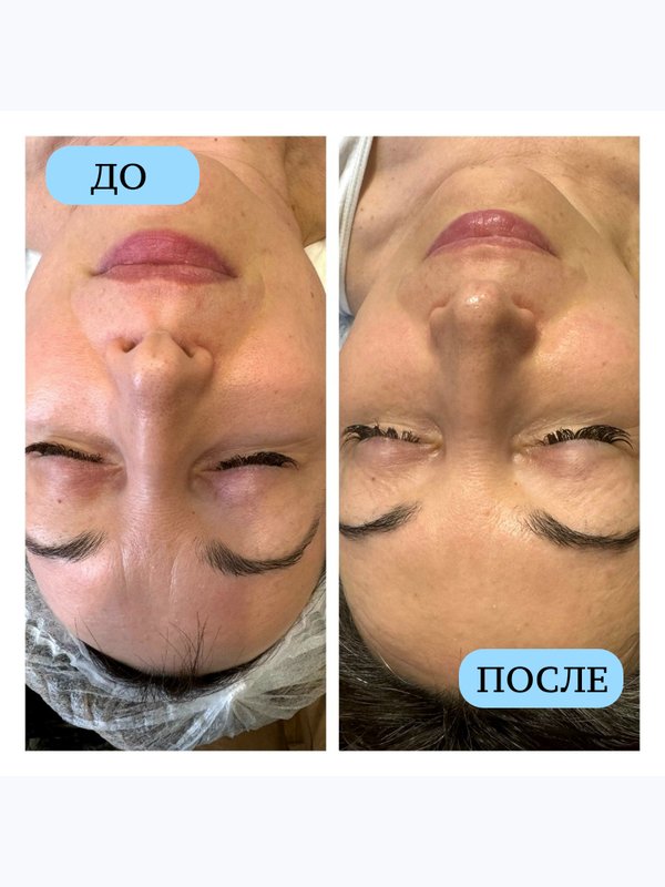 Косметическая кожа