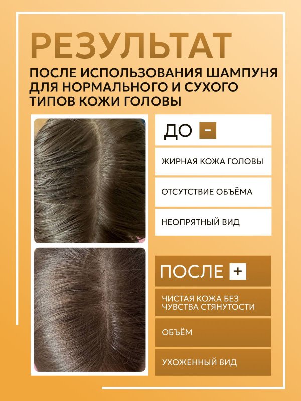 Шампунь для жирного типа кожи головы