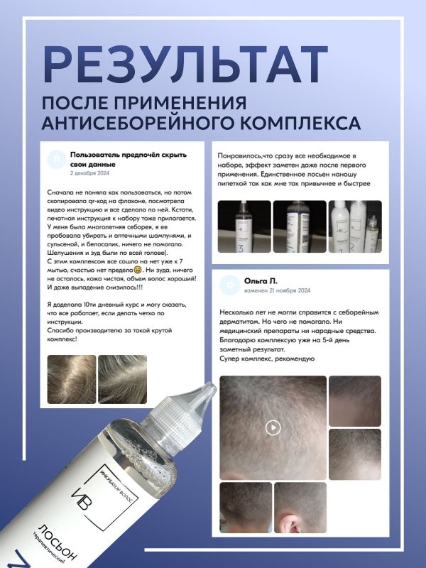 Антисеборейный комплекс от перхоти, зуда, корок, себорейного дерматита: маска, шампунь и лосьон