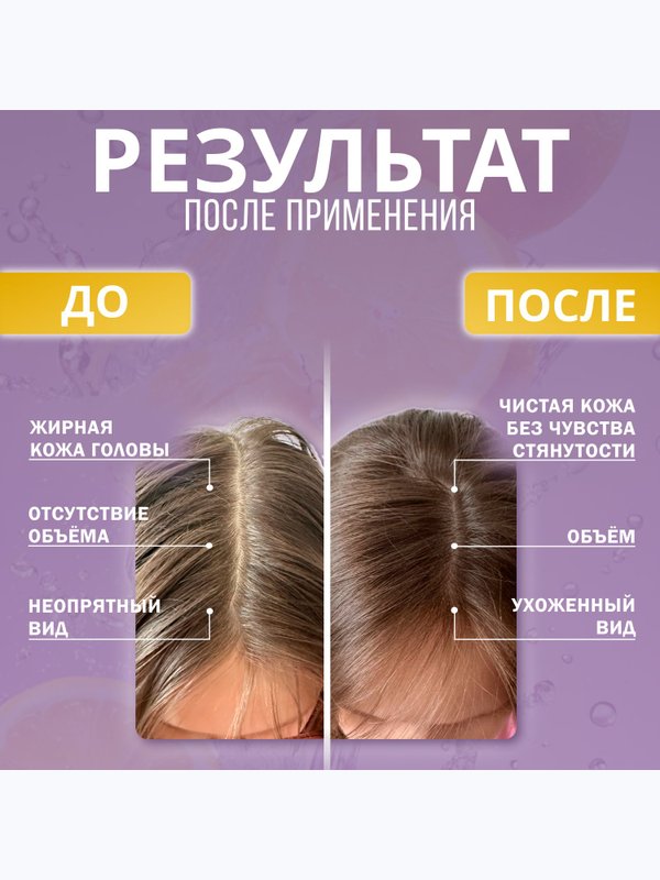 Шампунь для жирного типа кожи головы