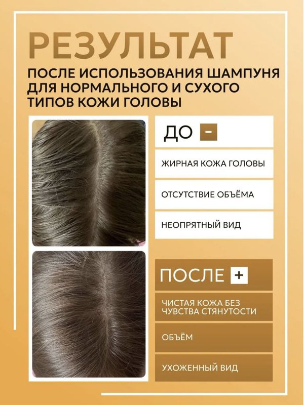 Шампунь для жирного типа кожи головы