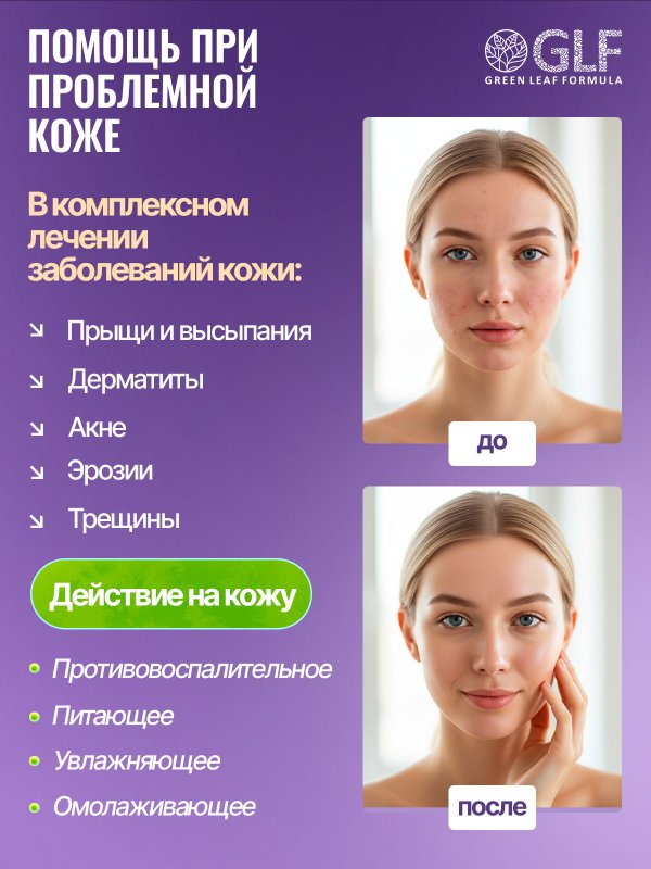 Витамины для кожи лица от прыщей и дерматитов, для ломких волос, для женщин биотин
