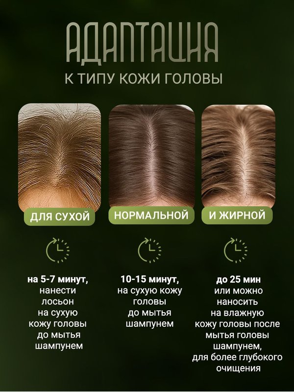 Детокс лосьон для кожи головы RASTIKULA 200мл, мультикислотный AHA+BHA пилинг, для очищения, свежести и роста волос