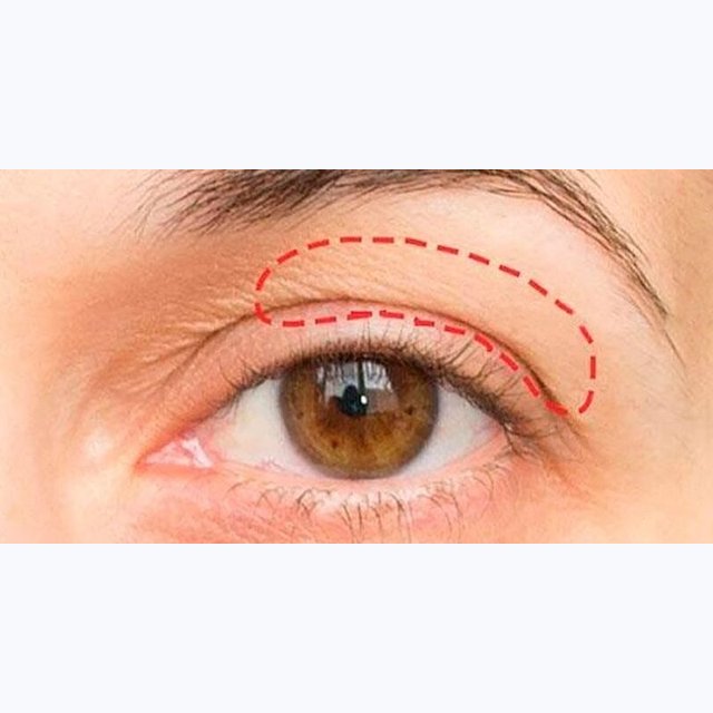 Нависшее веко национальность. Татуаж: глаза (межресничичное пространство + стрелка). Кантопексия лигатурная. Сайт работы веки. Сайт работы веки.