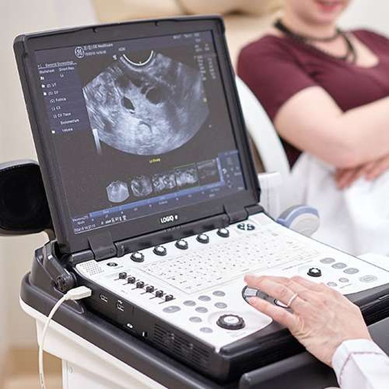 Узи вересаево. Ультразвуковое обследование. Оснащение кабинета узи. , 5, москва фото. Узи вересаево.