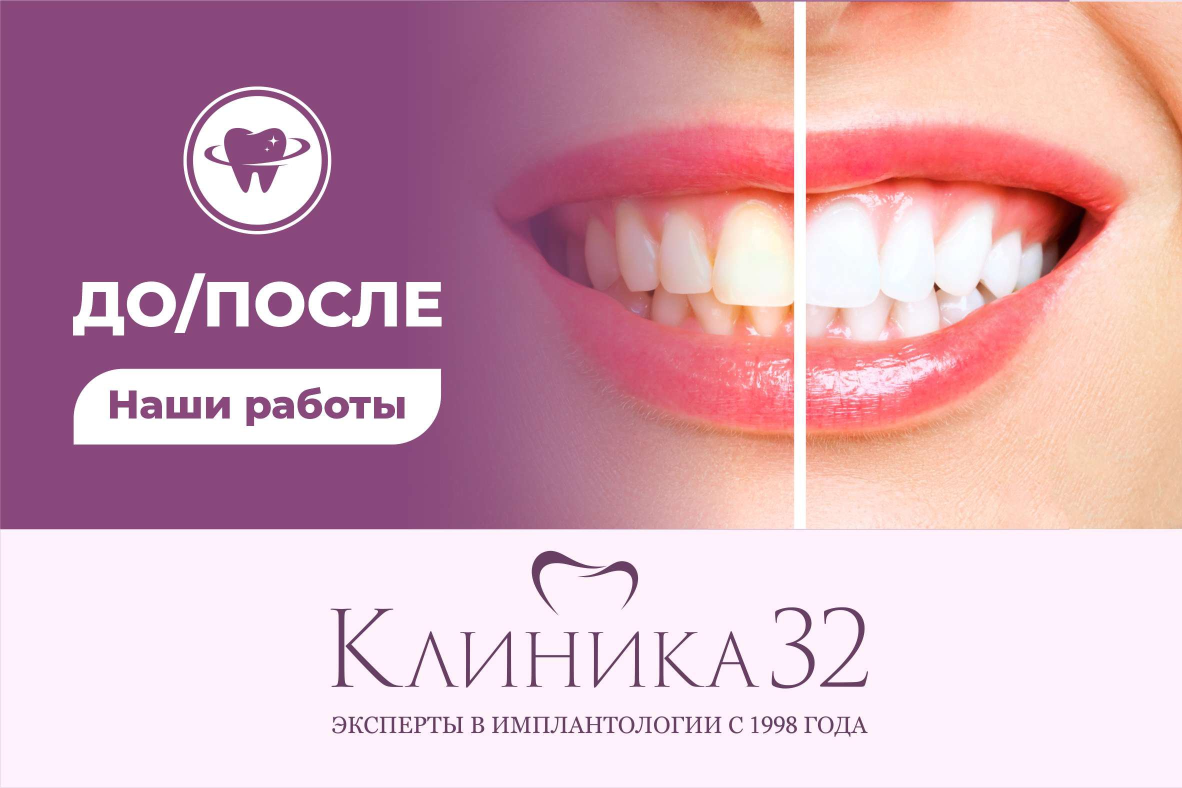 https://klinika-32.ru/before-after